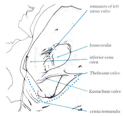 Eustachian Ridge What Is Eustachian Valve